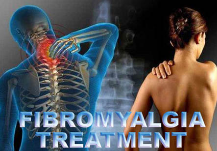 Fibromyalgia
