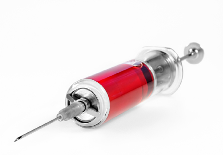 Joint Injection
