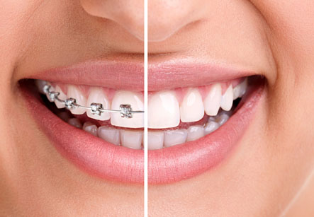 Orthodontics