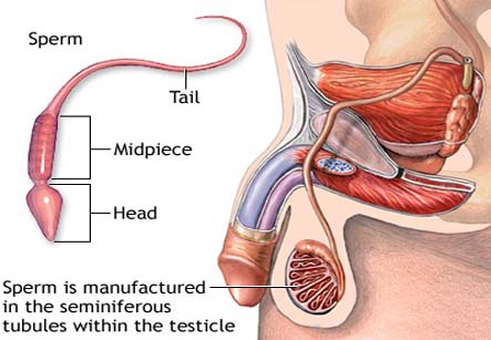Percutaneous Sperm Aspiration PESA